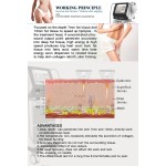 HIFU Machine Supplier - New Technology Face Lift Ice HIFU Ultrasound 9d