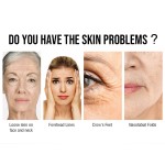 Facial Lifting Device Supplier - Small Laser Wrinkle Remover Facial Laser Lifting Machine