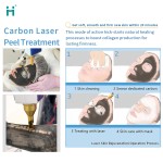 Tattoo Removal Machine Supplier - 1064nm Hair Removal Veins Removal Long Pulse Carbon Peel