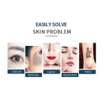 Tattoo Removal Machine Supplier - 5 in 1 Q Switched CE 3000w F12 Carbon Cream