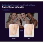 Laser Hair Removal Factory - 755nm ND YAG Epilation Alexander Gentle Long Pulse