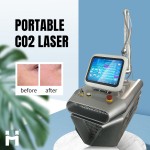 CO2 Laser Machine Supplier - Shandong Huamei New Wrinkle Removal Vaginal Tightening Medical