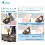 Nd Yag Laser Factory - OEM Q Switch Carbon Peel Removal Black Nevus Machine