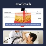 Collagen Laser Factory - 5D Collagen Long Pulse Skin Tightening Wrinkle Removal