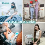 Nd Yag Laser Factory - OEM Q Switch Carbon Peel Removal Black Nevus Machine