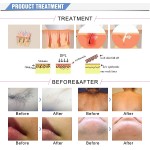 IPL Hair Removal Factory - Portable 7 in 1 Multifunction Opt Elight Skin Rejuvenation