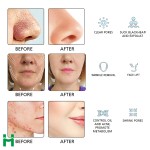 Scar Removal Machine Factory - Professional Exfoliate Diamond Dermabrasion Micro Crystal Machine