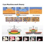 PDT Light Therapy Machine Supplier - 2025 Hot Sale Red Blue Led Professional Color Therapy