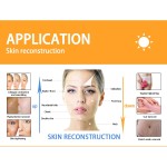 Fractional CO2 Laser Manufacturer - Picomei High Quality Best Price Vaginal Tightening Treatment