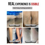 Hair Removal Machine Manufacturer - HUAMEI 4 Waves Ice Titanium Platinum 755 808 940 1064nm