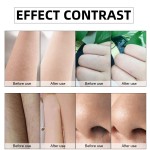 Diode Laser Equipment Manufacturer - 2025 Newest Titanium 755 808 940 1064nm 1600w Beauty Spa