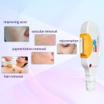 Laser Hair Removal Machine Supplier - Huamei 2023 New 2 In1 3 Wavelength 1064 755 808 Diode Ipl