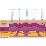Jet Peel Machine Factory - Huamei Professional Facial Hydration Water Oxygen Pore Cleansing High Pressure