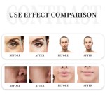 LED PDT Machine Supplier - 2025 Newest 3-5 Color Light Therapy for Skin Rejuvenation