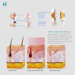 IPL Hair Removal Factory - Portable 7 in 1 Multifunction Opt Elight Skin Rejuvenation