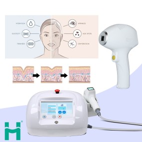 Laser Wrinkle Removal Machine Factory - Portable Fractional Handle OEM 1470nm Skin Tightening