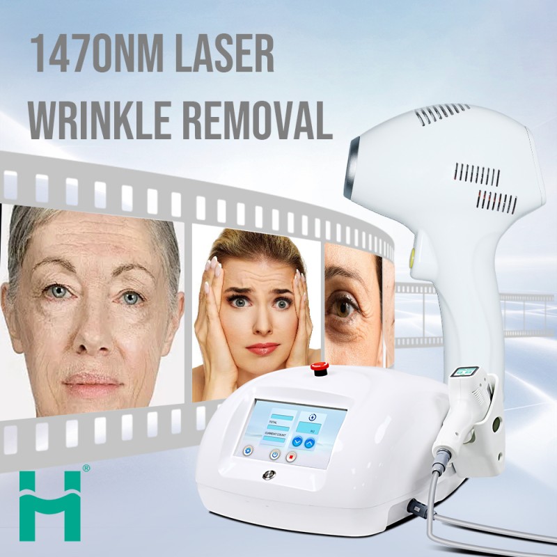 Laser Wrinkle Remover Factory - 1470nm Face Lifting Anti-wrinkle Machine