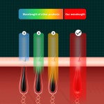 Diode Laser Machine Manufacturer - Professional 755nm 808nm 1064nm Multi-wavelength Hair Removal