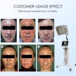 Phototherapy Machine Factory - LED Infrared Light Therapy for Facial Skin Whitening Rejuvenation