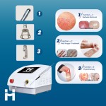 Dental Laser Machine Supplier - 980nm for Soft Tissue Surgery Oral Treatment Canal Therapy