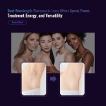 Laser Hair Removal Manufacturer - 2025 Trending 1064nm 755nm Long Pulse Alexandrite Machine