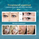 Water Jet Peel Machine Factory - Korea High-pressure Needle-free Injection Skin Care Cleansing Oxygen