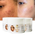 Face Cream Supplier - Brighten Whiten Anti Aging Quickly Moisturize Remove Acne