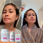 Collagen Capsules Supplier - OME Supplement Marine Fish Skin Hydrolysed Pure Marine Bio