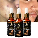 Hyaluronic Acid Serum Manufacturer - Vitamin E Vitamin C Spot Removal Brightening Anti Aging