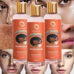 Essential Oils Factory - High Quality Skincare Brighten Tender Skin Removing Dark Spots Organic