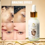 Glutathione Serum Factory - High Quality Vitamin C Double Acne Removal Mark Brightening