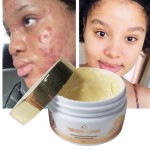 Face Cream Supplier - Pure Turmeric Vitamin C Natural Skin Brightening Acne Dark Spots Removal