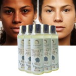 Whitening Oil Supplier - 100% Natural Kojic Acid MSDS CE Certified Skin Whitening Oil