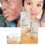 Skin Care Set Manufacturer - Turmeric Brightening Skin Set Acne Spot Removal Facial Cleaning