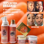 Skin Care Set Manufacturer - Whitening Natural Beauty Product Moisturizing Face Dark Spot Remove