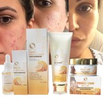 Skin Care Set Manufacturer - Turmeric Brightening Skin Set Acne Spot Removal Facial Cleaning