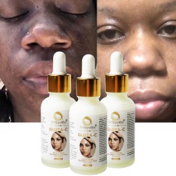 Glutathione Serum Factory - High Quality Vitamin C Double Acne Removal Mark Brightening