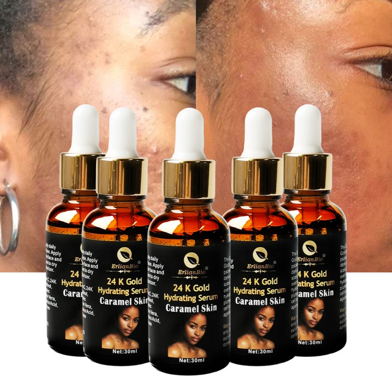 Hyaluronic Acid Serum Manufacturer - Vitamin E Vitamin C Spot Removal Brightening Anti Aging