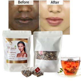 Skin Whitening Tea Factory - Free Sample Custom 30 Bag Smooth Tea Healthy Lightening Women