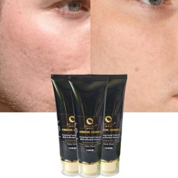 Face Cleanser Supplier - Hot Selling Charcoal Eliminate Acne Black Spots Brighten