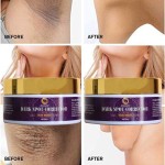 Spot Removal Cream Factory - Hot Selling Black Spot Removal Underarm Whitening Brightening