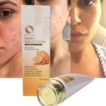 Facial Cleanser Factory - Top Quality Acne Treatment Remove Dark Spot Best Skin Care Turmeric