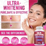 Skin Whitening Capsules Supplier - Skin Lightening Capsules Whitening Pills Reduce Dark Spots Beauty