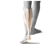 Kinesiology Tape Manufacturer - Calf Arch Pre-Cut Cotton Elastic Kinesiology Tape Manufacture