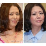 RF皮肤紧致仪器厂家-4D空化超声RF皮肤紧致设备