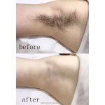 二极管激光脱毛器生产厂家-厂家直供3000W便携三波段女性设备