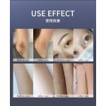 激光脱毛设备厂家-新款二极管皮秒二合一洗纹身仪器