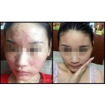 LED光疗面罩厂家-7色PDT LED红光治疗面罩面部护理美白面罩