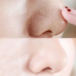 Nose Strips Supplier - Stock Female/Male Blackhead Remover Patch Cotton Sheet Convenient