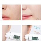 Liquid Thread Face Lifting Supplier - Hot Selling Self-Seal Sterilization Skin Tightening